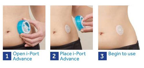 i-port after insertion
