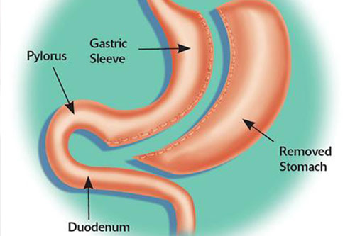 diabetes, thyroid and endocrinology treatment in Kochi