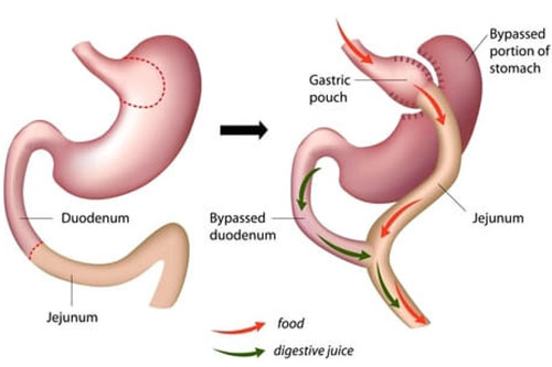 diabetes, thyroid and endocrinology treatment in Kochi
