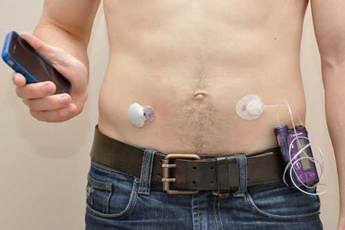 diabetes, thyroid and endocrinology treatment in Kochi