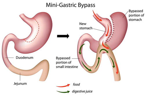 diabetes, thyroid and endocrinology treatment in Kochi